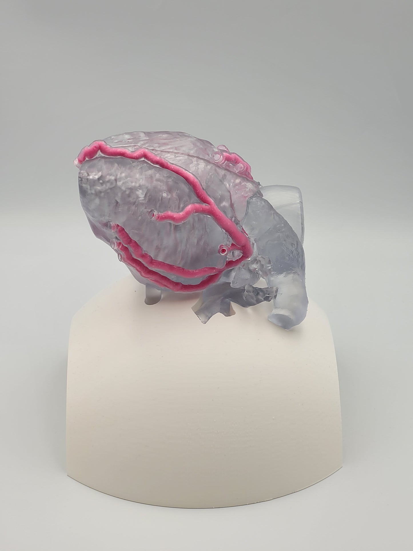 Khawaja Radiopaque Coronary Artery Model