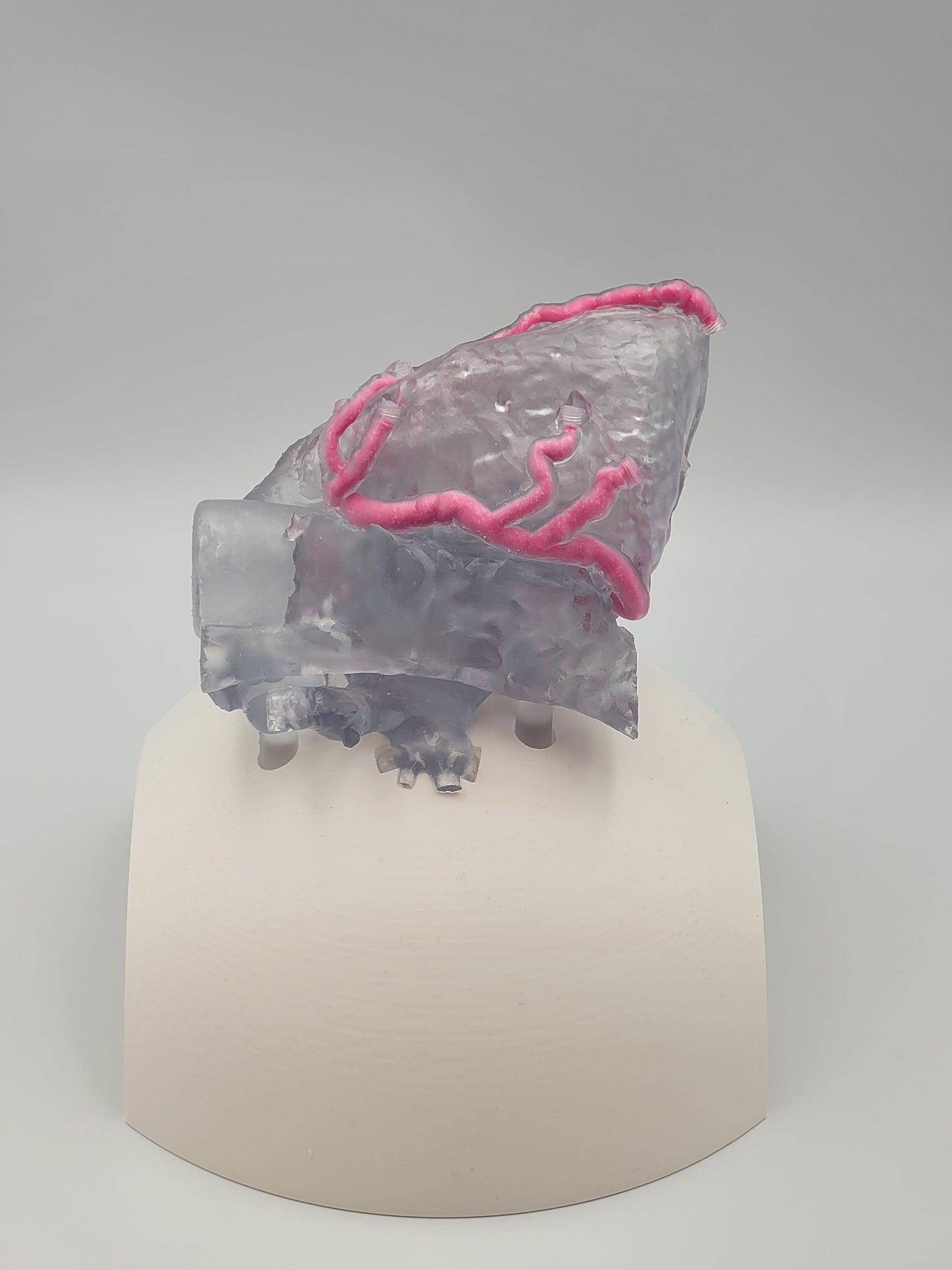 Khawaja Radiopaque Coronary Artery Model