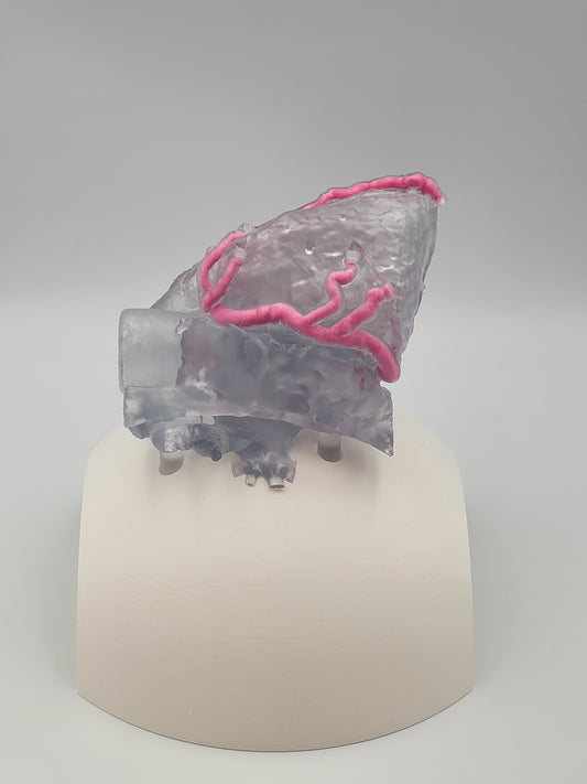 Khawaja Radiopaque Coronary Artery Model