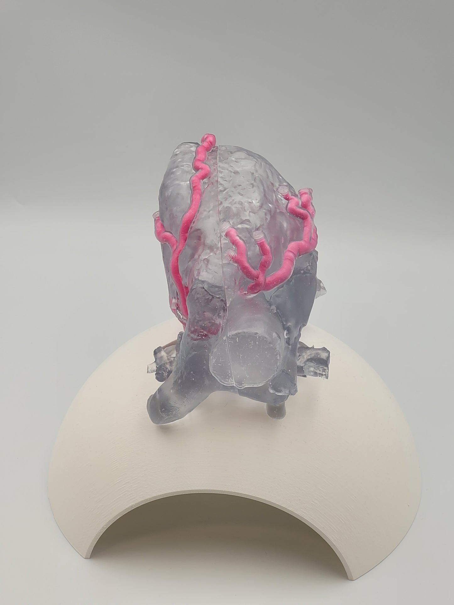 Khawaja Radiopaque Coronary Artery Model